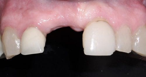 Gap between upper front teeth visible.