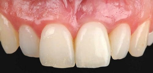 Close-up of healthy teeth and gums.