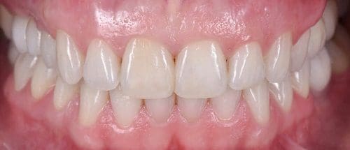 Close-up of healthy human teeth and gums.