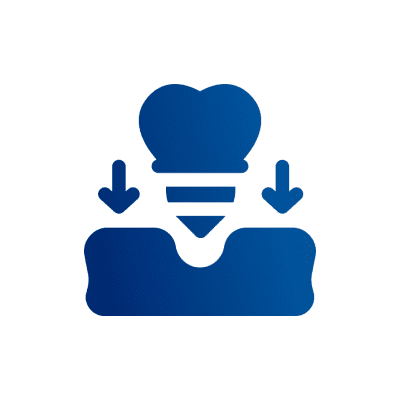 Dental implant icon with downward arrows.