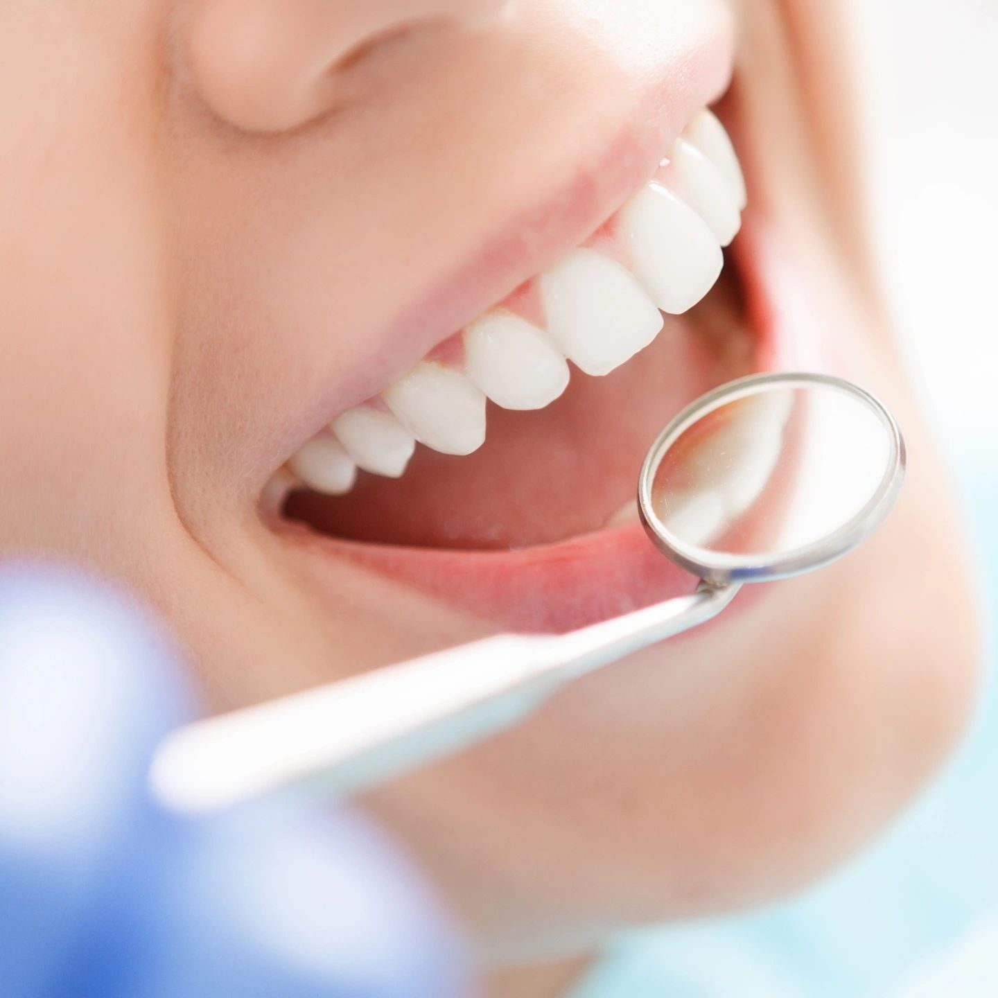 Person smiling during dental check-up.